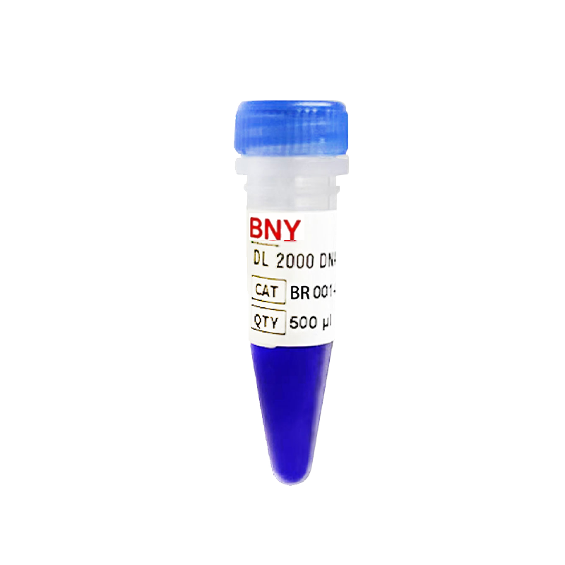 DL2000 DNA Marker